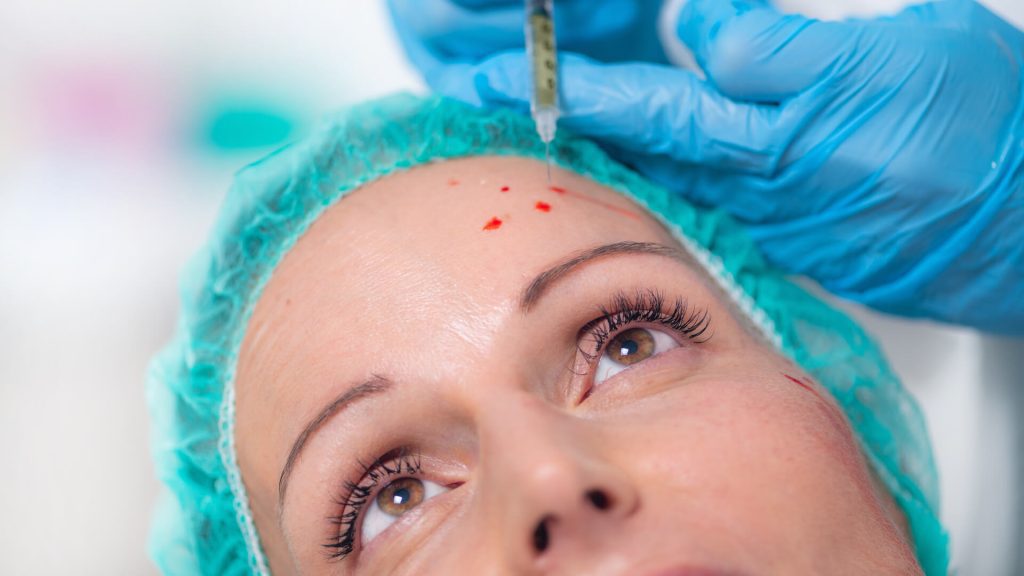 PRP or Platelet Rich Plasma Cosmetic Face Treatment